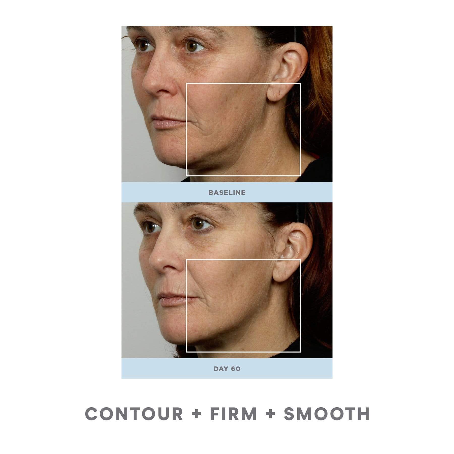 NuFace Trinity Pro